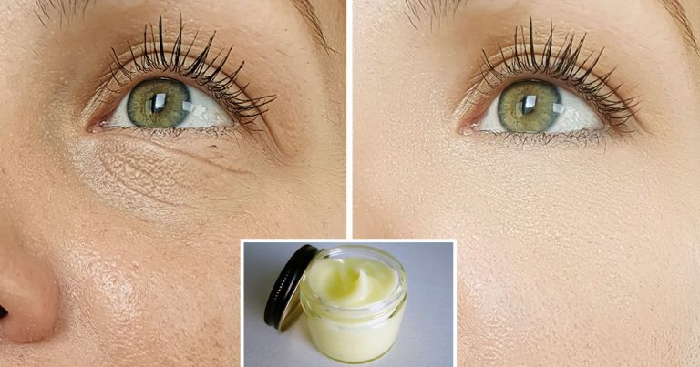 Contorno Occhi Maschera Fai Da Te Di 3 Ingredienti Per Attenuare Le Rughe 